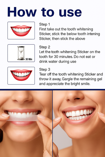 Teeth Whitening Strips – Safe, Gentle & Effective