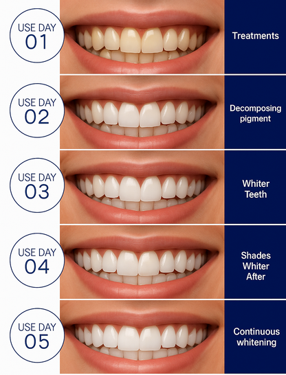 Teeth Whitening Strips – Safe, Gentle & Effective